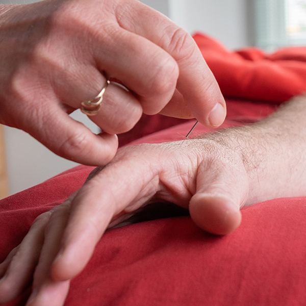 Acupuncture Christchurch